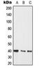 Mitogen-Activated Protein Kinase Kinase 3 antibody, MBS8238802, MyBioSource, Western Blot image 