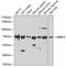 RB Binding Protein 5, Histone Lysine Methyltransferase Complex Subunit antibody, A04563, Boster Biological Technology, Western Blot image 