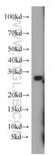 Major Histocompatibility Complex, Class II, DQ Alpha 2 antibody, 55072-1-AP, Proteintech Group, Western Blot image 