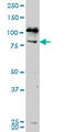 NIMA Related Kinase 5 antibody, LS-C139219, Lifespan Biosciences, Western Blot image 