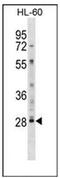 Lymphocyte Antigen 6 Family Member G6F antibody, AP52565PU-N, Origene, Western Blot image 