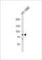 CHM Like Rab Escort Protein antibody, 61-049, ProSci, Western Blot image 