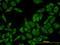 Ribosomal Protein L13 antibody, LS-C198107, Lifespan Biosciences, Immunofluorescence image 