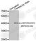 Mitogen-Activated Protein Kinase Kinase 6 antibody, AP0081, ABclonal Technology, Western Blot image 