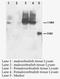 Patatin Like Phospholipase Domain Containing 6 antibody, LS-C172020, Lifespan Biosciences, Western Blot image 