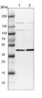 Proteasome 26S Subunit, Non-ATPase 6 antibody, NBP1-81545, Novus Biologicals, Western Blot image 