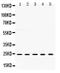 Metalloproteinase inhibitor 2 antibody, PB9830, Boster Biological Technology, Western Blot image 