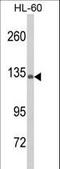 Complement C5 antibody, LS-C168151, Lifespan Biosciences, Western Blot image 