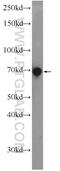 Rhophilin Rho GTPase Binding Protein 2 antibody, 12671-1-AP, Proteintech Group, Enzyme Linked Immunosorbent Assay image 