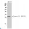 Troponin I3, Cardiac Type antibody, LS-C813532, Lifespan Biosciences, Western Blot image 