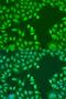 Phosphatase And Tensin Homolog antibody, LS-C746996, Lifespan Biosciences, Immunofluorescence image 
