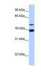 Inhibin Subunit Alpha antibody, NBP1-58280, Novus Biologicals, Western Blot image 