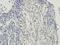 Rho Associated Coiled-Coil Containing Protein Kinase 2 antibody, orb19530, Biorbyt, Immunohistochemistry paraffin image 