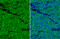 CD20 antibody, GTX100209, GeneTex, Immunohistochemistry paraffin image 