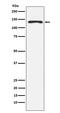 NEDD4 E3 Ubiquitin Protein Ligase antibody, M00984, Boster Biological Technology, Western Blot image 