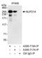 NUP214 antibody, A300-717A, Bethyl Labs, Immunoprecipitation image 