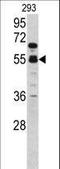 Coagulation Factor X antibody, LS-C167877, Lifespan Biosciences, Western Blot image 