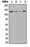 TAO Kinase 1 antibody, LS-C368537, Lifespan Biosciences, Western Blot image 