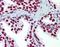 Protein Kinase, DNA-Activated, Catalytic Subunit antibody, A00645, Boster Biological Technology, Immunohistochemistry paraffin image 