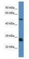 SHC Adaptor Protein 3 antibody, NBP1-79656, Novus Biologicals, Western Blot image 