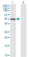 Aldehyde Dehydrogenase 9 Family Member A1 antibody, LS-C196644, Lifespan Biosciences, Western Blot image 