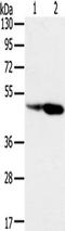 Sorting Nexin 8 antibody, TA350441, Origene, Western Blot image 