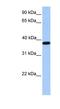 Actin Related Protein T2 antibody, NBP1-54626, Novus Biologicals, Western Blot image 