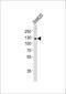 WW Domain Containing E3 Ubiquitin Protein Ligase 2 antibody, M03634, Boster Biological Technology, Western Blot image 