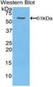 Thrombospondin 4 antibody, LS-C302474, Lifespan Biosciences, Western Blot image 