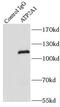 ATPase Sarcoplasmic/Endoplasmic Reticulum Ca2+ Transporting 1 antibody, FNab00699, FineTest, Immunoprecipitation image 