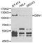 Drebrin 1 antibody, STJ28449, St John