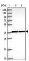 Zinc Finger Protein 707 antibody, PA5-60886, Invitrogen Antibodies, Western Blot image 