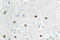 MutS Homolog 6 antibody, LS-C176981, Lifespan Biosciences, Immunohistochemistry paraffin image 