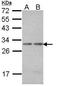 Proteasome Subunit Alpha 7 antibody, TA308945, Origene, Western Blot image 