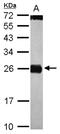 Cell Death Inducing DFFA Like Effector C antibody, NBP2-15902, Novus Biologicals, Western Blot image 