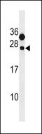 C-Type Lectin Domain Containing 6A antibody, 60-095, ProSci, Western Blot image 