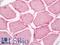 Elongin C antibody, LS-C318438, Lifespan Biosciences, Immunohistochemistry paraffin image 
