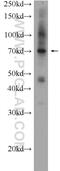 AKT Interacting Protein antibody, 14860-1-AP, Proteintech Group, Western Blot image 
