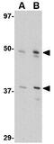 Fasciculation and elongation protein zeta-2 antibody, GTX85422, GeneTex, Western Blot image 