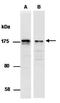 SWI/SNF Related, Matrix Associated, Actin Dependent Regulator Of Chromatin Subfamily C Member 2 antibody, orb66716, Biorbyt, Western Blot image 