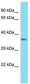 Olfactory Receptor Family 51 Subfamily B Member 6 antibody, TA334897, Origene, Western Blot image 