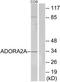 Adenosine A2a Receptor antibody, TA311793, Origene, Western Blot image 