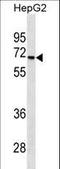 Serine/Threonine Kinase 39 antibody, LS-C161567, Lifespan Biosciences, Western Blot image 