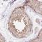 Lipase H antibody, HPA049079, Atlas Antibodies, Immunohistochemistry paraffin image 