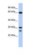 Myogenic factor 5 antibody, orb329602, Biorbyt, Western Blot image 