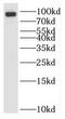 RING finger protein 10 antibody, FNab07335, FineTest, Western Blot image 