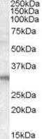 Four And A Half LIM Domains 2 antibody, PA5-18259, Invitrogen Antibodies, Western Blot image 