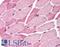 Madh7 antibody, LS-B120, Lifespan Biosciences, Immunohistochemistry paraffin image 