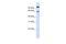 CDR antibody, A01792, Boster Biological Technology, Western Blot image 