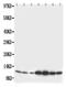 S100 Calcium Binding Protein B antibody, PA1303, Boster Biological Technology, Western Blot image 